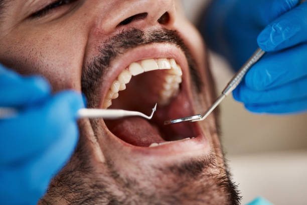 Best Urgent Care for Lost Fillings or Crowns in Pitcairn, PA