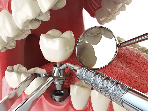 Best Emergency Denture Repair in Pitcairn, PA
